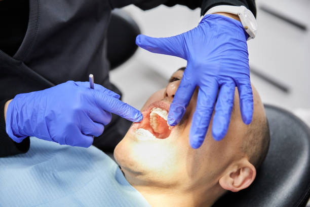 Best Emergency Cosmetic Dentistry (e.g., broken veneers) in El Sobrante, CA