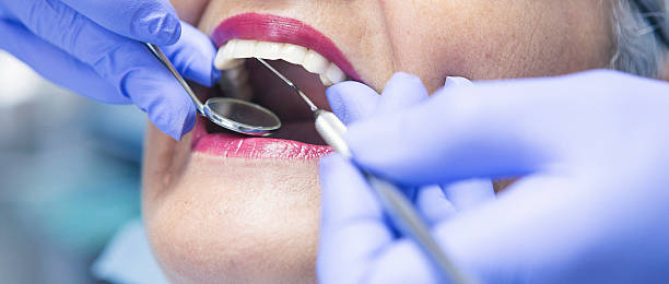Best Dental Abscess Treatment in El Sobrante, CA